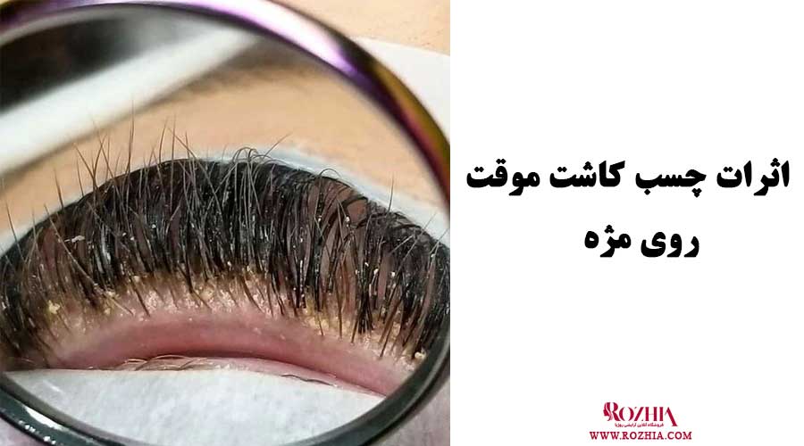 تفاوت کاشت مژه و اکستنشن مژه